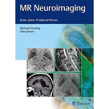 MR Neuroimaging de Olav Jansen MR Neuroimaging de Olav Jansen