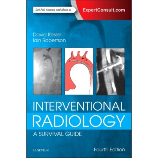 Interventional Radiology: A Survival Guide de David Kessel