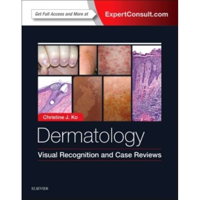 Dermatology: Visual Recognition and Case Reviews de Christine J. Ko