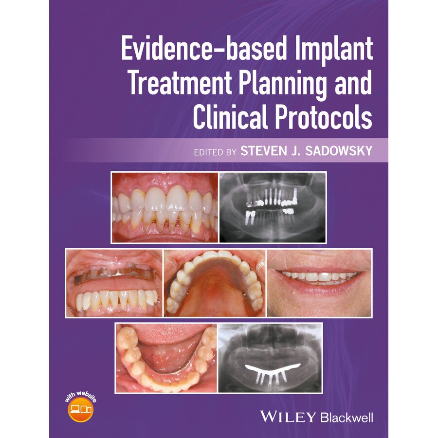 Evidence/-/based Implant Treatment Planning and Clinical Protocols de Steven J. Sadowsky