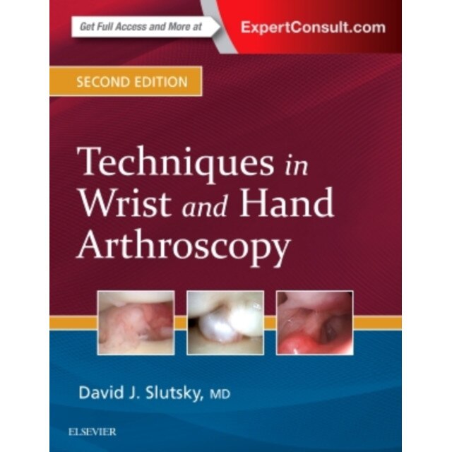 Techniques in Wrist and Hand Arthroscopy de David J. Slutsky