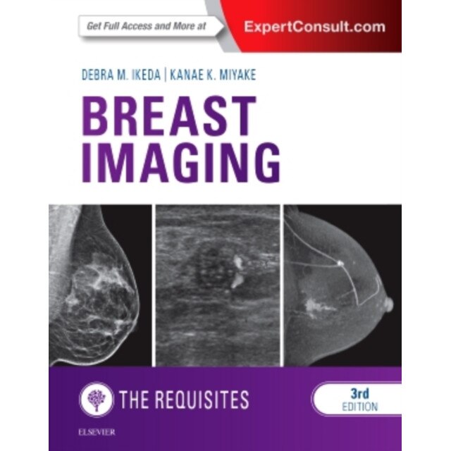 Breast Imaging: The Requisites de Debra Ikeda