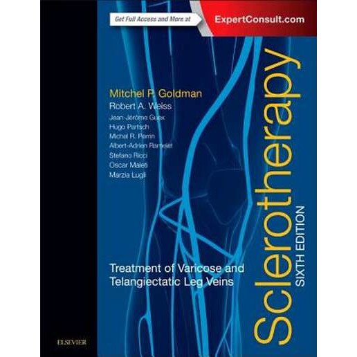 Sclerotherapy de Mitchel P. Goldman