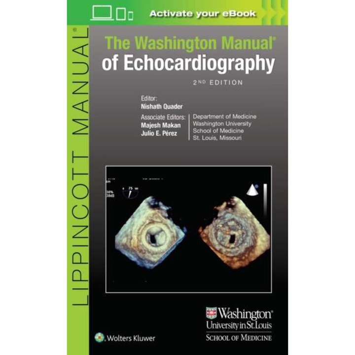 The Washington Manual of Echocardiography de Nishath Quader