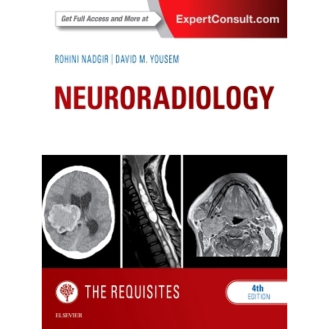 Neuroradiology: The Requisites de Rohini Nadgir