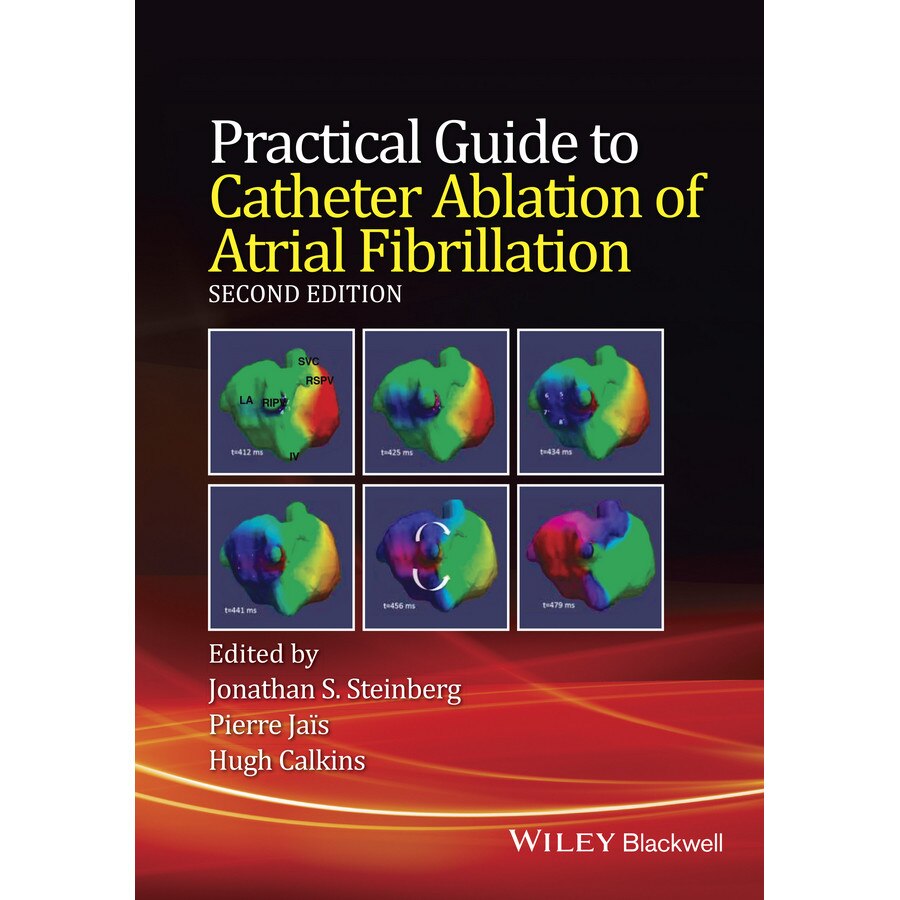 Practical Guide to Catheter Ablation of Atrial Fibrillation de Jonathan S. Steinberg
