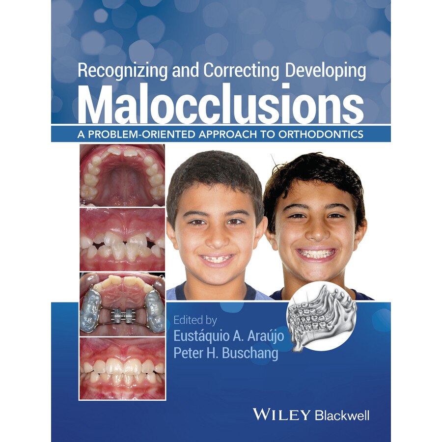 Recognizing and Correcting Developing Malocclusions de Eustáquio A. Araújo