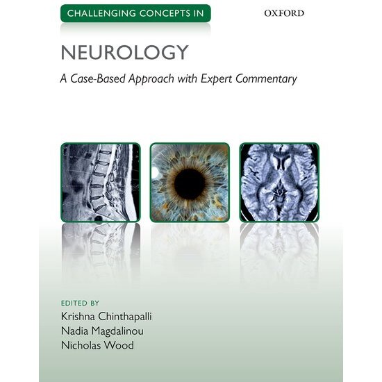 Challenging Concepts in Neurology de Krishna Chinthapalli