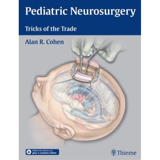 Pediatric Neurosurgery: Tricks of the Trade de Alan R. Cohen