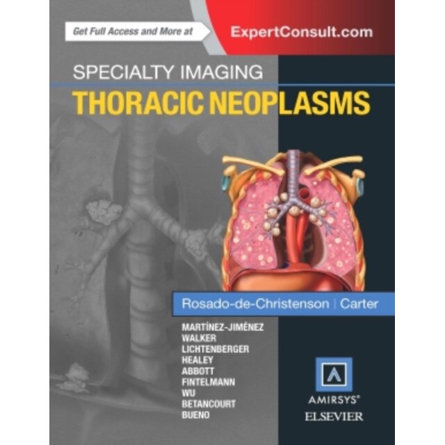 Specialty Imaging: Thoracic Neoplasms de Melissa L. Rosado-de-Christenson