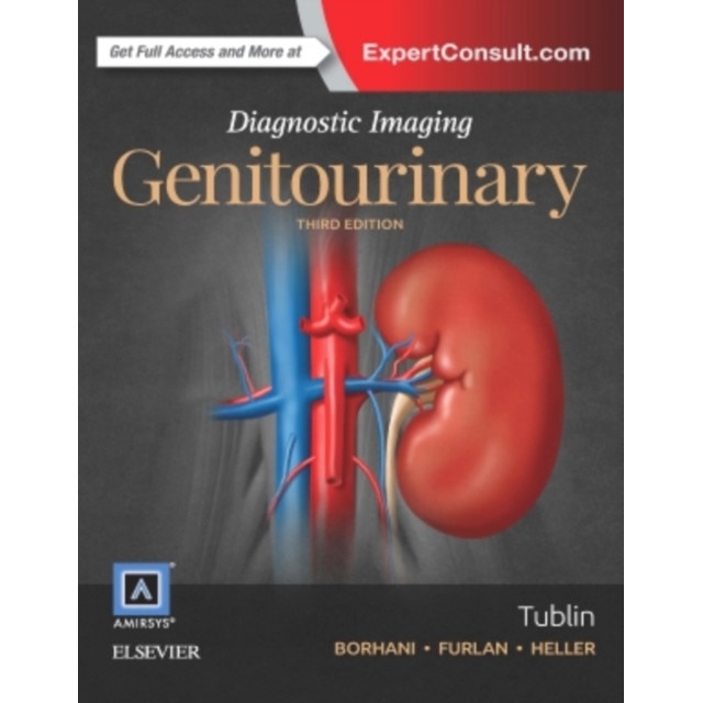 Diagnostic Imaging: Genitourinary de Mitchell E. Tublin