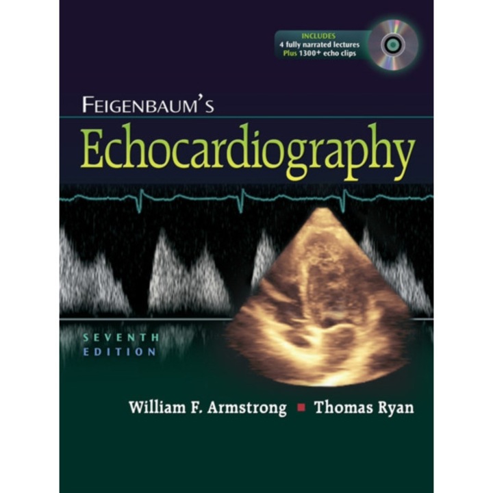 Feigenbaum's Echocardiography de William F. Armstrong MD