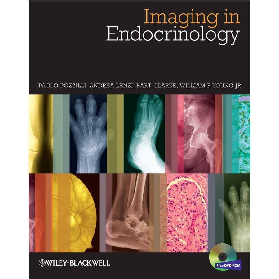 Imaging in Endocrinology de Paolo Pozzilli