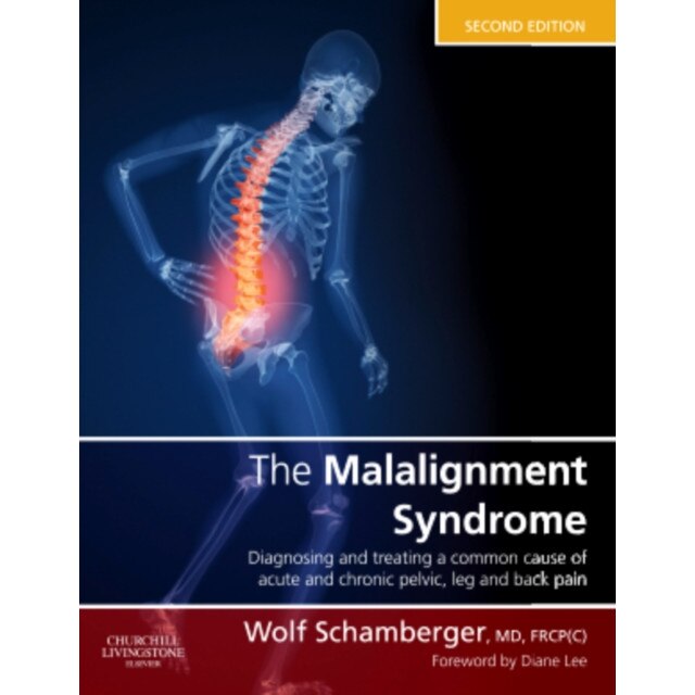 The Malalignment Syndrome de Wolf Schamberger