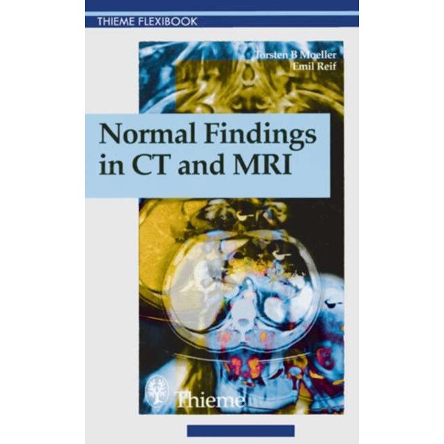 Normal Findings in CT and MRI de Torsten Bert Moeller