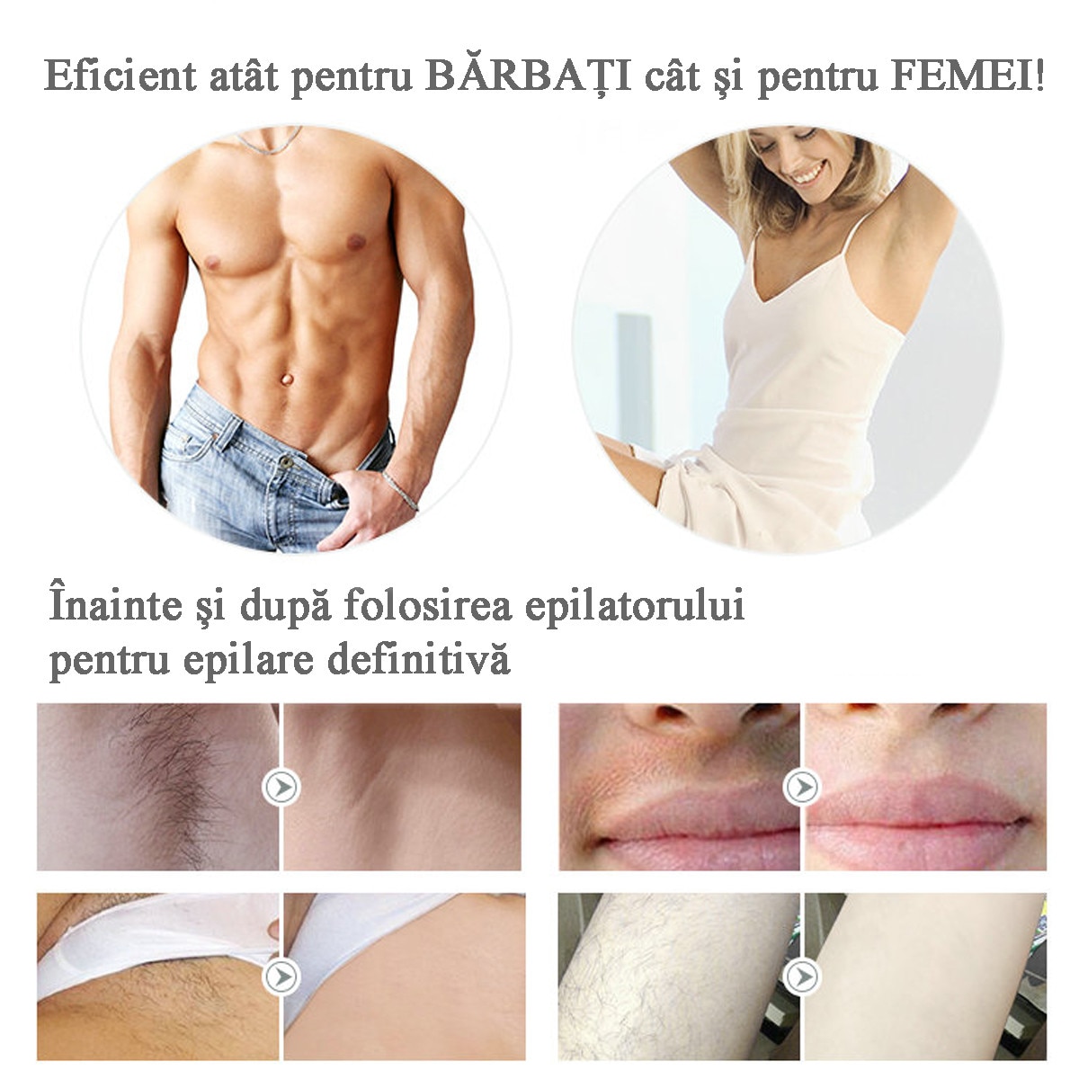 de ce nu este un epilator cu varicoza)