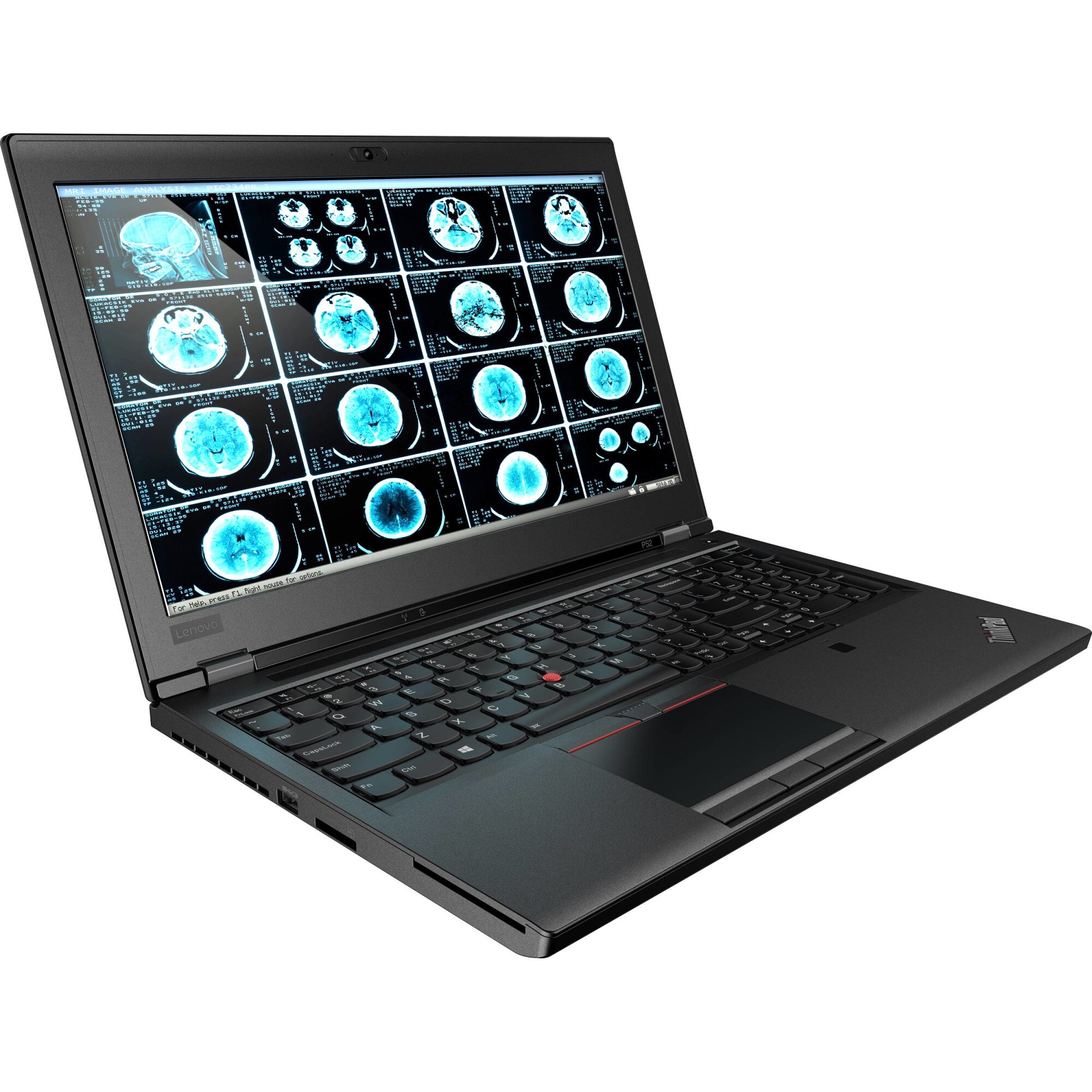 Laptop Lenovo ThinkPad P52 Intel Core i7-8850H 2.60 GHz up to 4.30