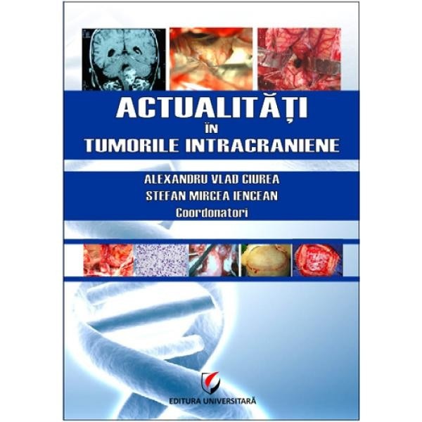 Actualitati in tumorile intracraniene - Alexandru V Ciurea, Stefan Mircea Iencean