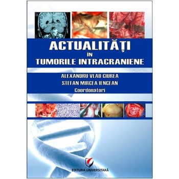 Actualitati in tumorile intracraniene - Alexandru V Ciurea, Stefan Mircea Iencean Actualitati in tumorile intracraniene - Alexandru V Ciurea, Stefan Mircea Iencean