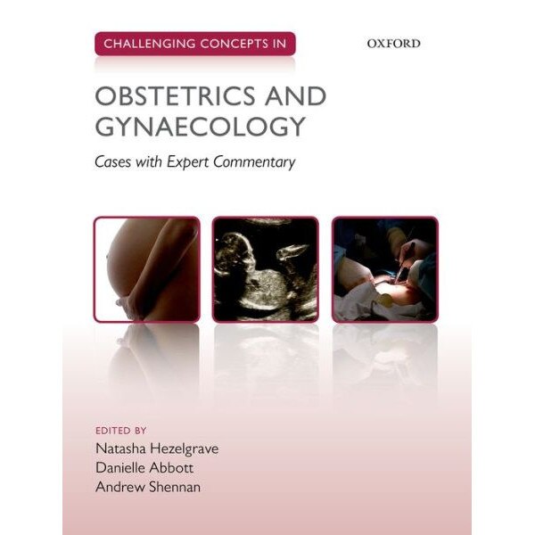 Challenging Concepts in Obstetrics and Gynaecology de Natasha Hezelgrave