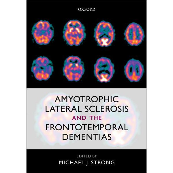 Amyotrophic Lateral Sclerosis and the Frontotemporal Dementias de Michael J. Strong