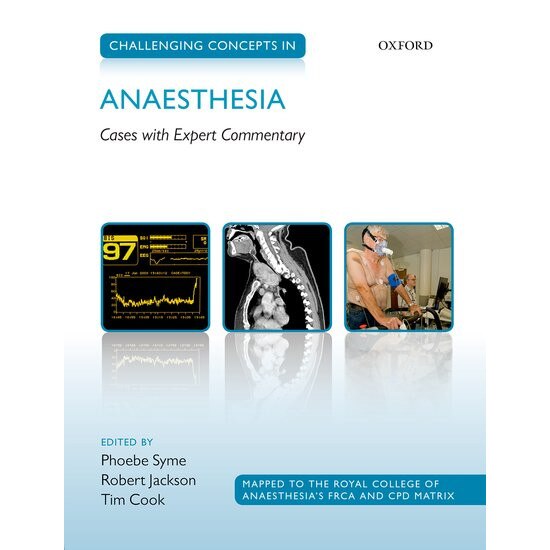 Challenging Concepts in Anaesthesia de Phoebe Syme
