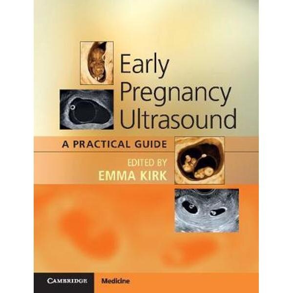 Early Pregnancy Ultrasound