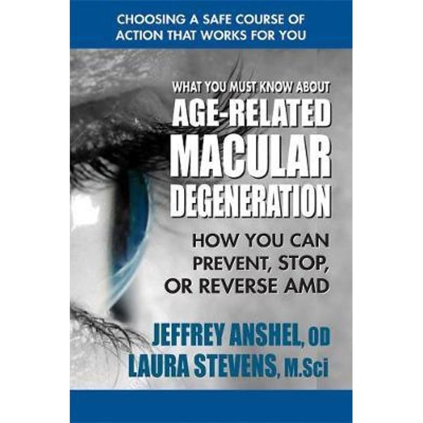 What You Must Know About Age-Related Macular Degenration