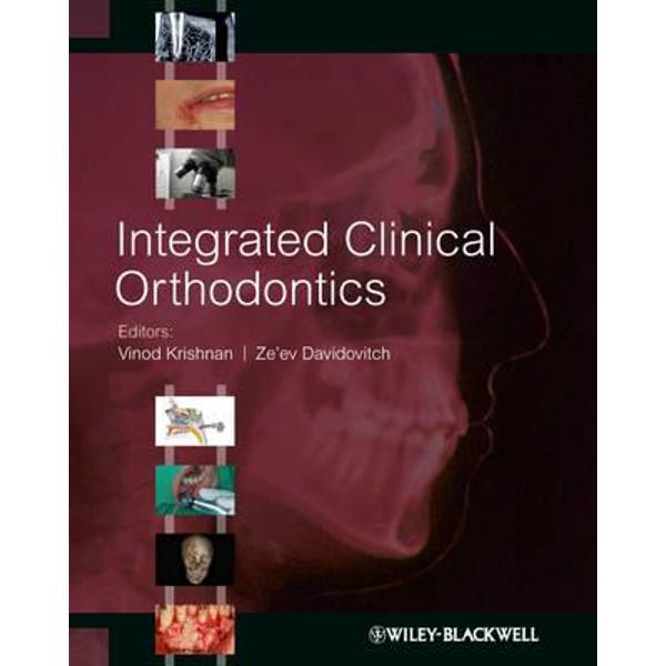 Integrated Clinical Orthodontics
