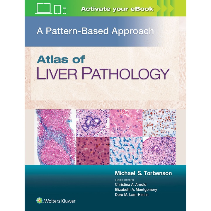 Atlas of Liver Pathology: A Pattern-Based Approach de Michael Torbenson MD