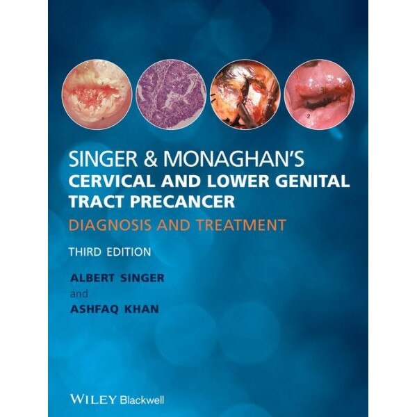 Singer and Monaghan′s Cervical and Lower Genital Tract Precancer de Albert Singer
