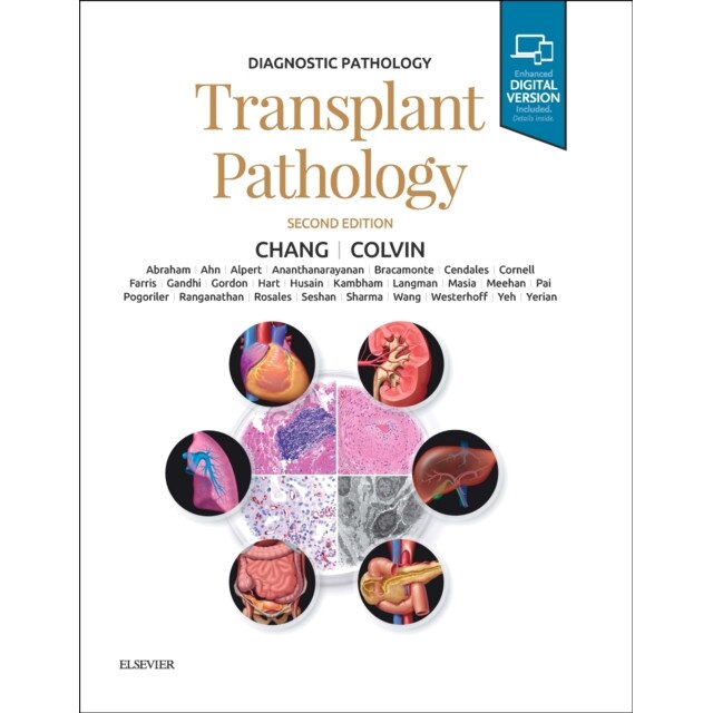 Diagnostic Pathology: Transplant Pathology de Anthony C. Chang