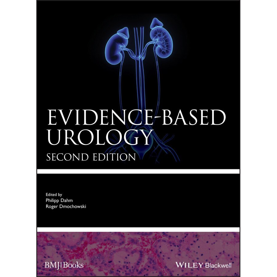 Evidence/-/based Urology de Philipp Dahm