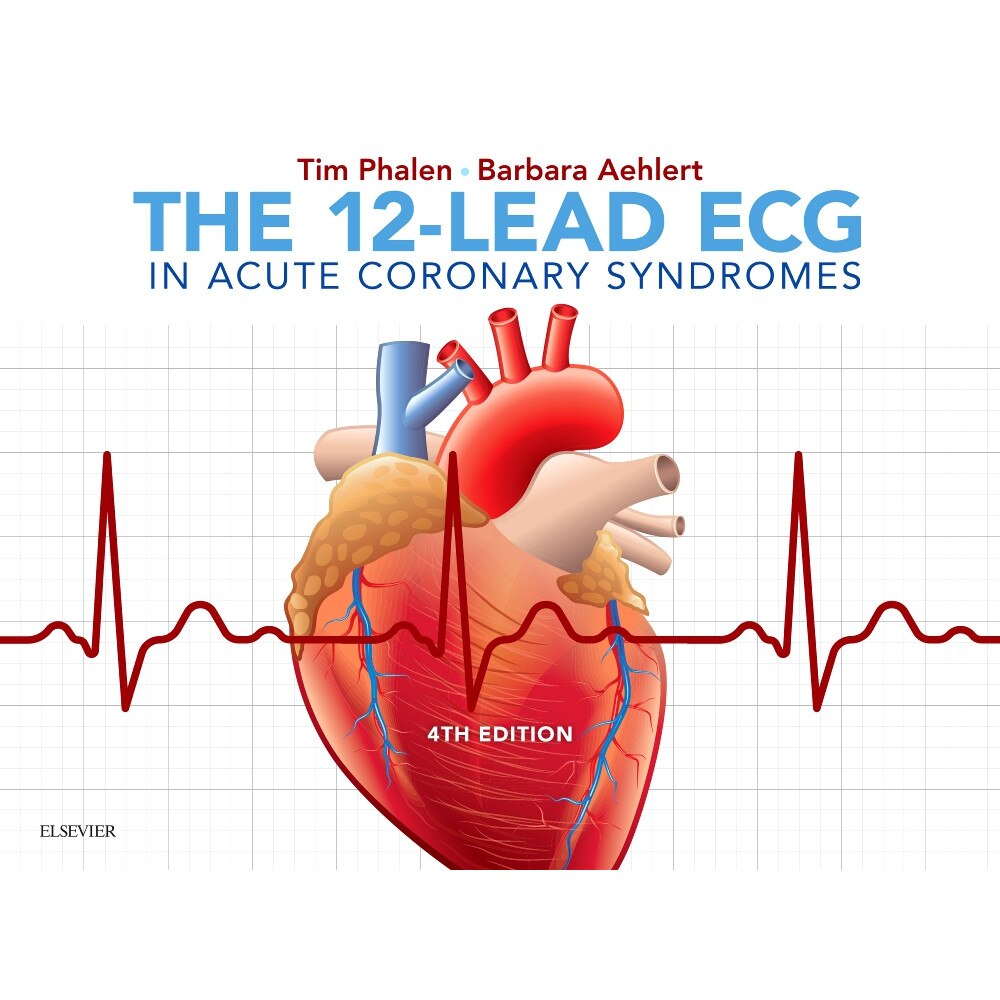 The 12-Lead ECG in Acute Coronary Syndromes de Tim Phalen