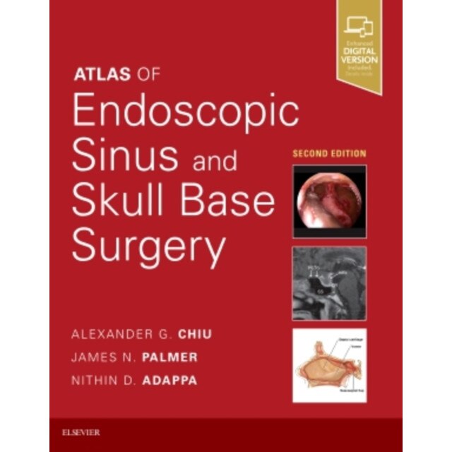 Atlas of Endoscopic Sinus and Skull Base Surgery de Alexander G. Chiu