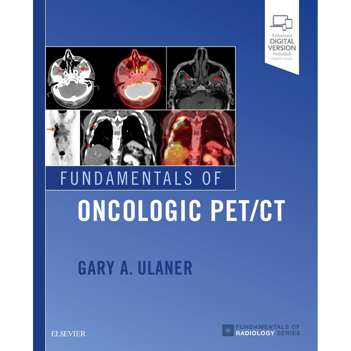 Fundamentals of Oncologic PET/CT de Gary A. Ulaner
