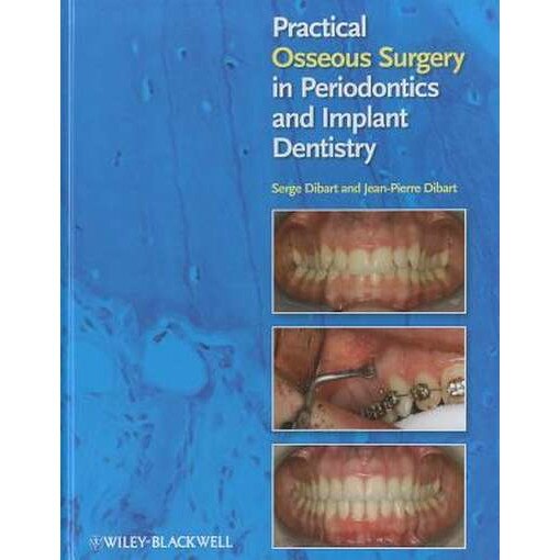 Practical Osseous Surgery in Periodontics and Implant Dentistry de Serge Dibart