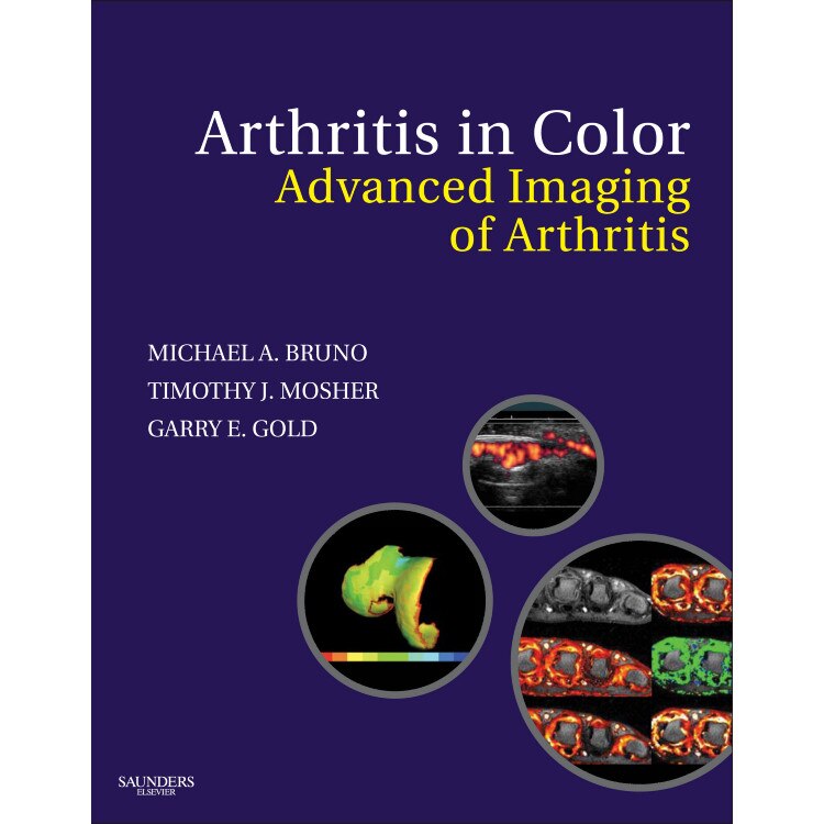 Arthritis in Color de Michael A. Bruno