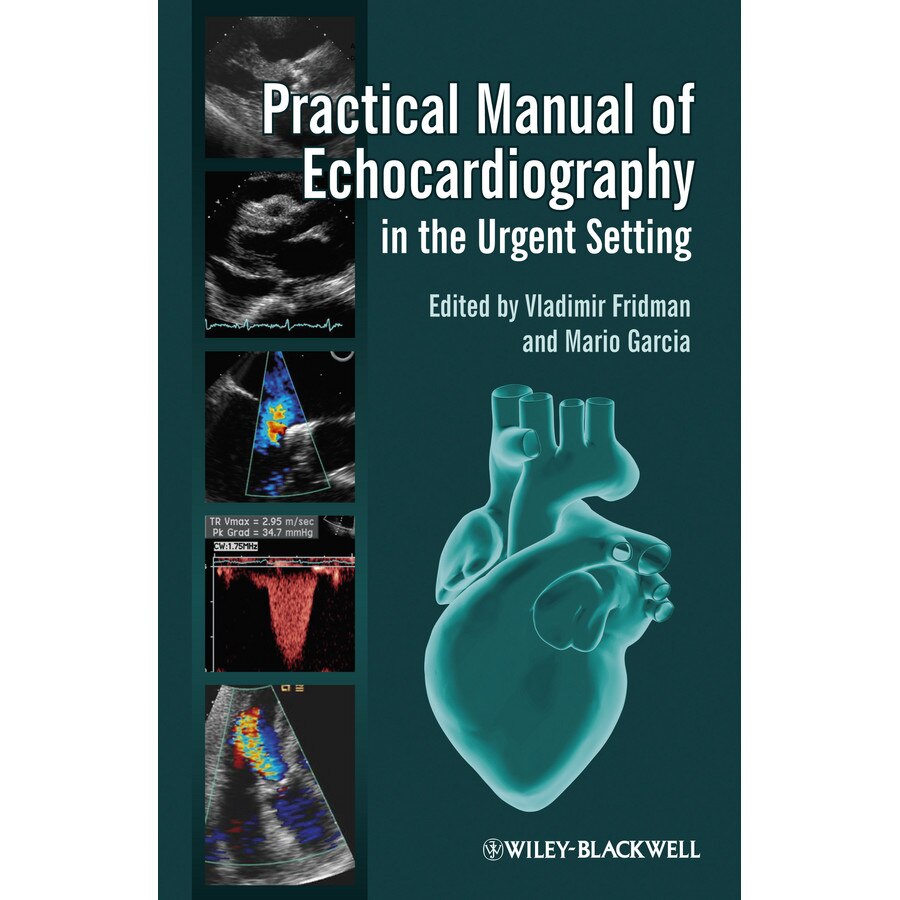 Practical Manual of Echocardiography in the Urgent Setting de Vladimir Fridman