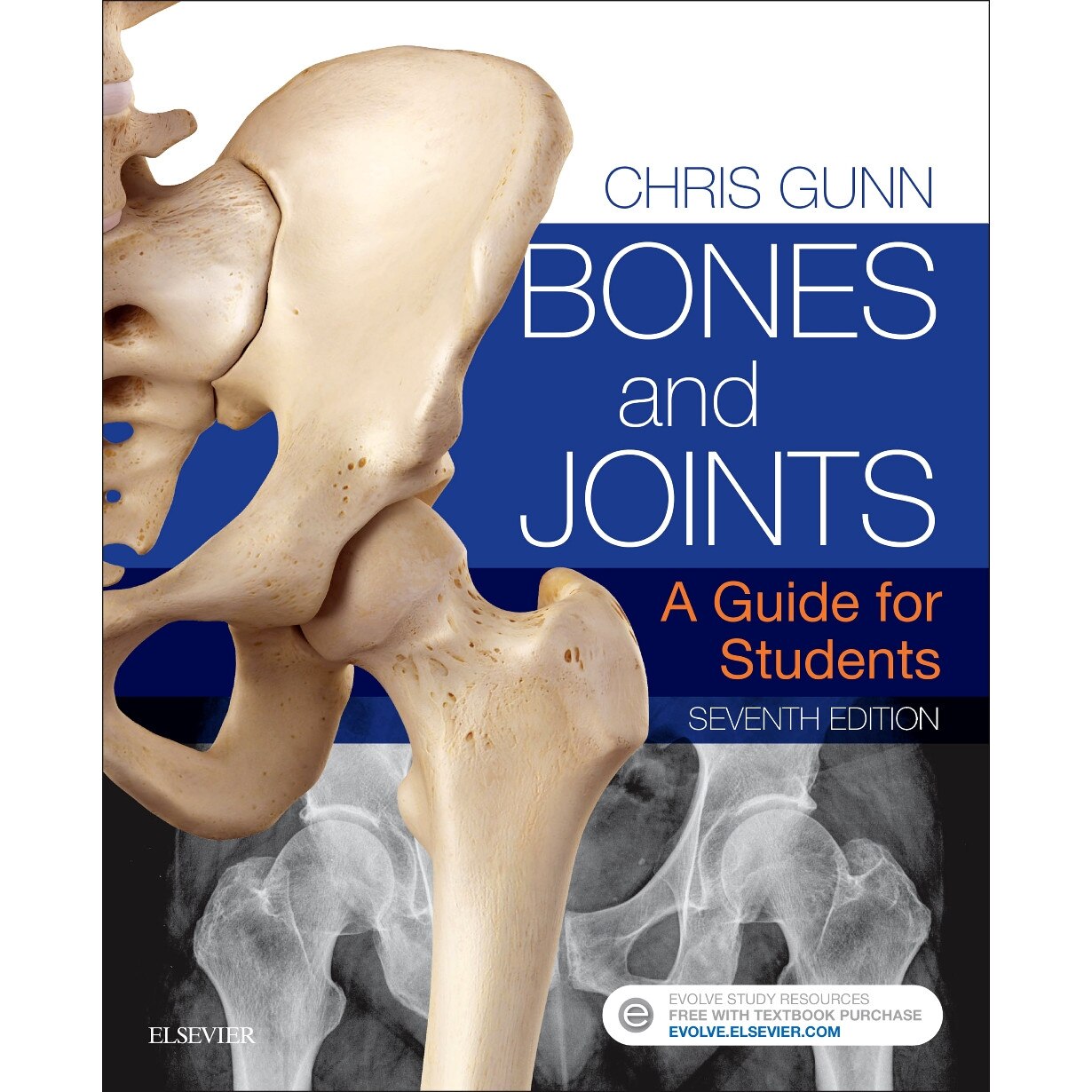 Bones and Joints de Chris Gunn