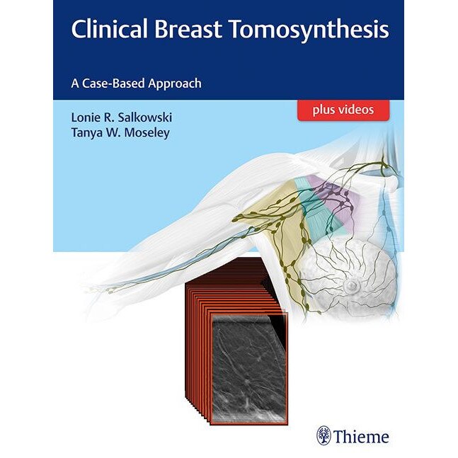 Clinical Breast Tomosynthesis de Lonie R. Salkowski