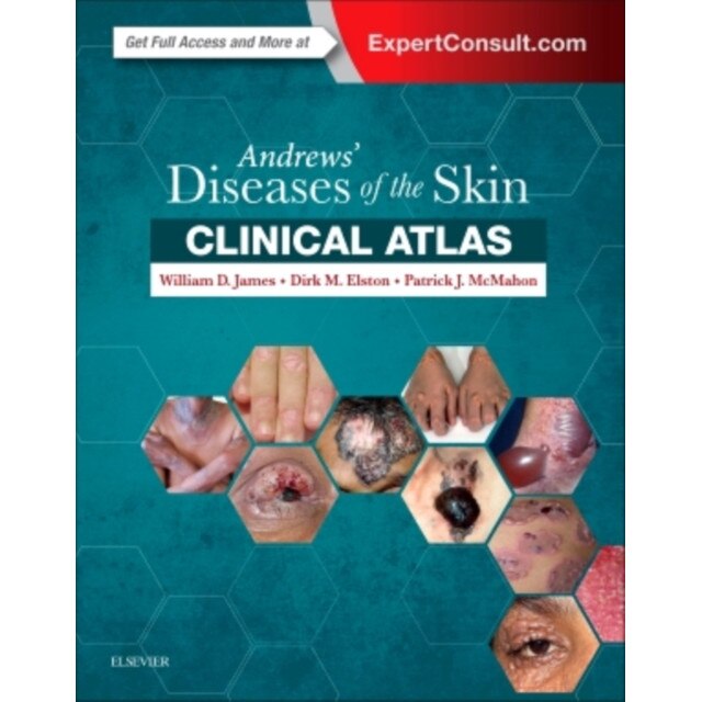 Andrews' Diseases of the Skin Clinical Atlas de William D. James