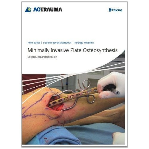 Minimally Invasive Plate Osteosynthesis (MIPO) De Reto Babst - EMAG.ro