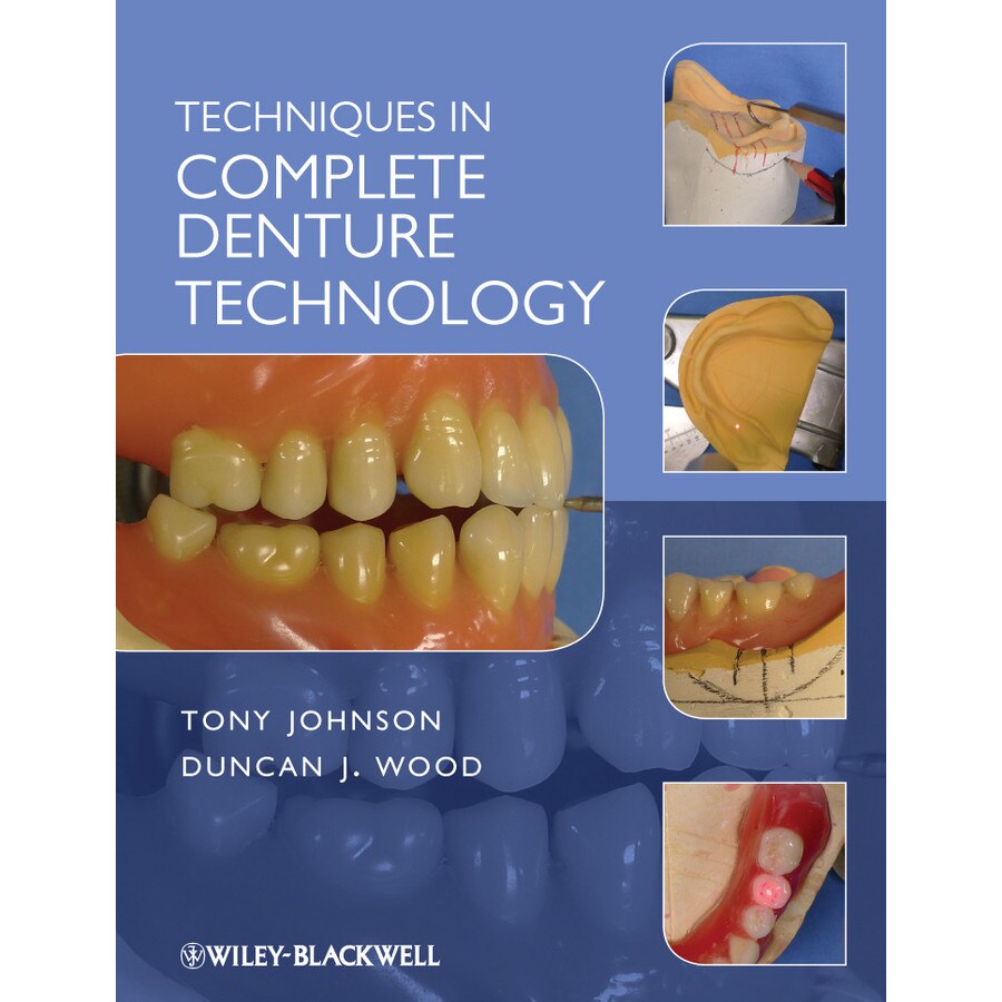 Techniques in Complete Denture Technology de Tony Johnson