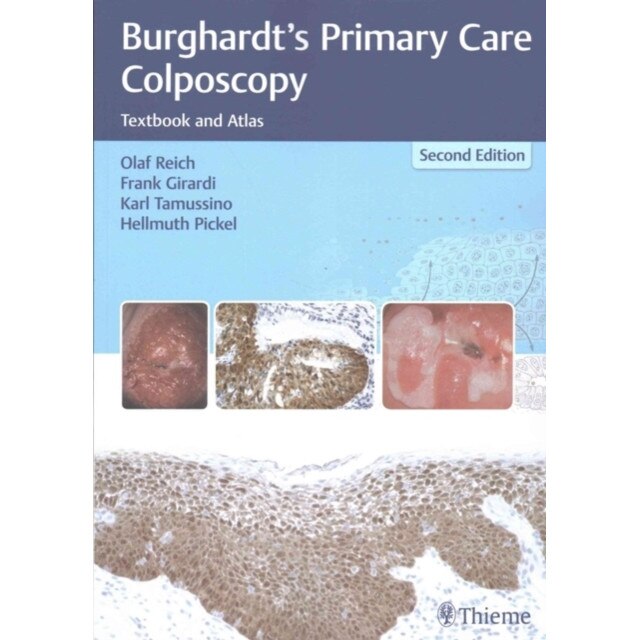 Burghardt's Primary Care Colposcopy de Olaf Reich