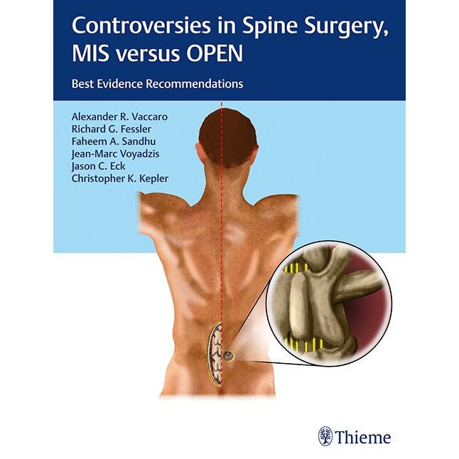 Controversies in Spine Surgery: MIS versus OPEN de Alexander R. Vaccaro