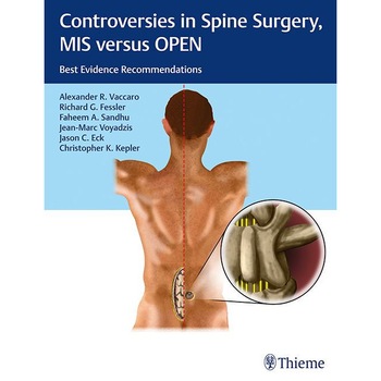 Controversies in Spine Surgery: MIS versus OPEN de Alexander R. Vaccaro Controversies in Spine Surgery: MIS versus OPEN de Alexander R. Vaccaro