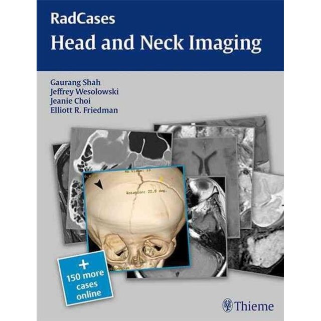 Head and Neck Imaging de Gaurang Vrindavan Shah