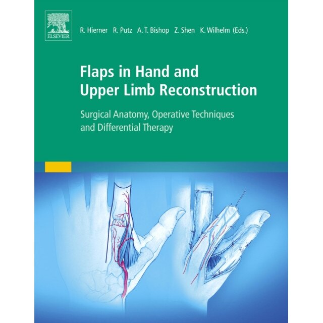 Flaps in Hand and Upper Limb Reconstruction de Ulrike Brugger