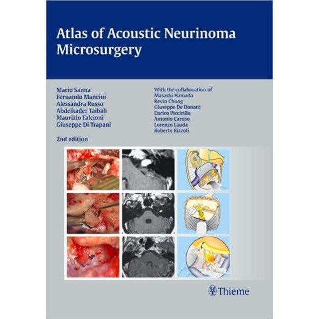 Atlas of Acoustic Neurinoma Microsurgery de Mario Sanna